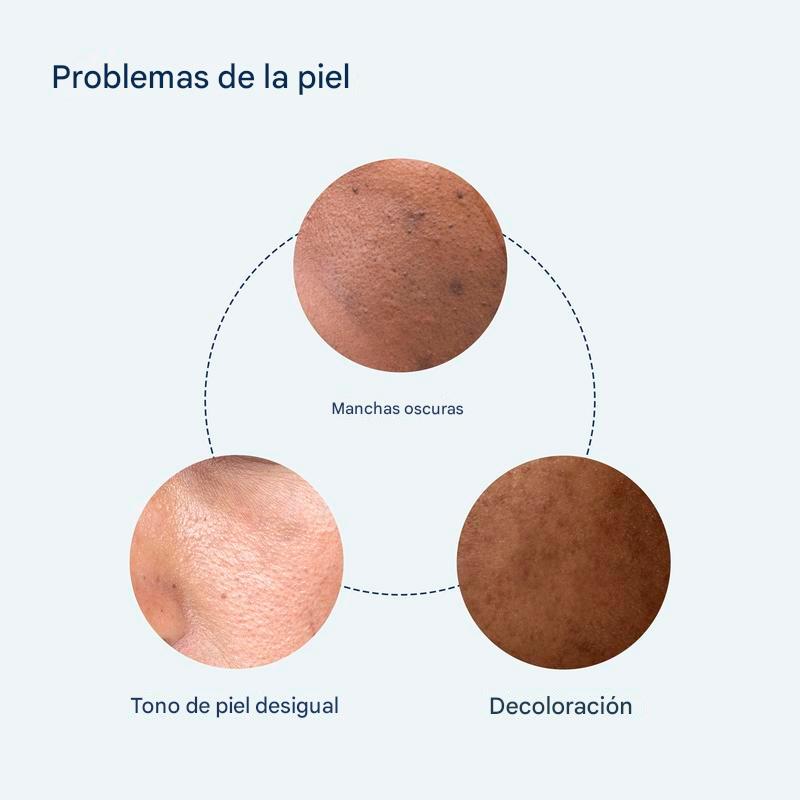 Sérum puntos negros