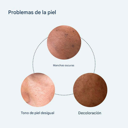 Sérum puntos negros
