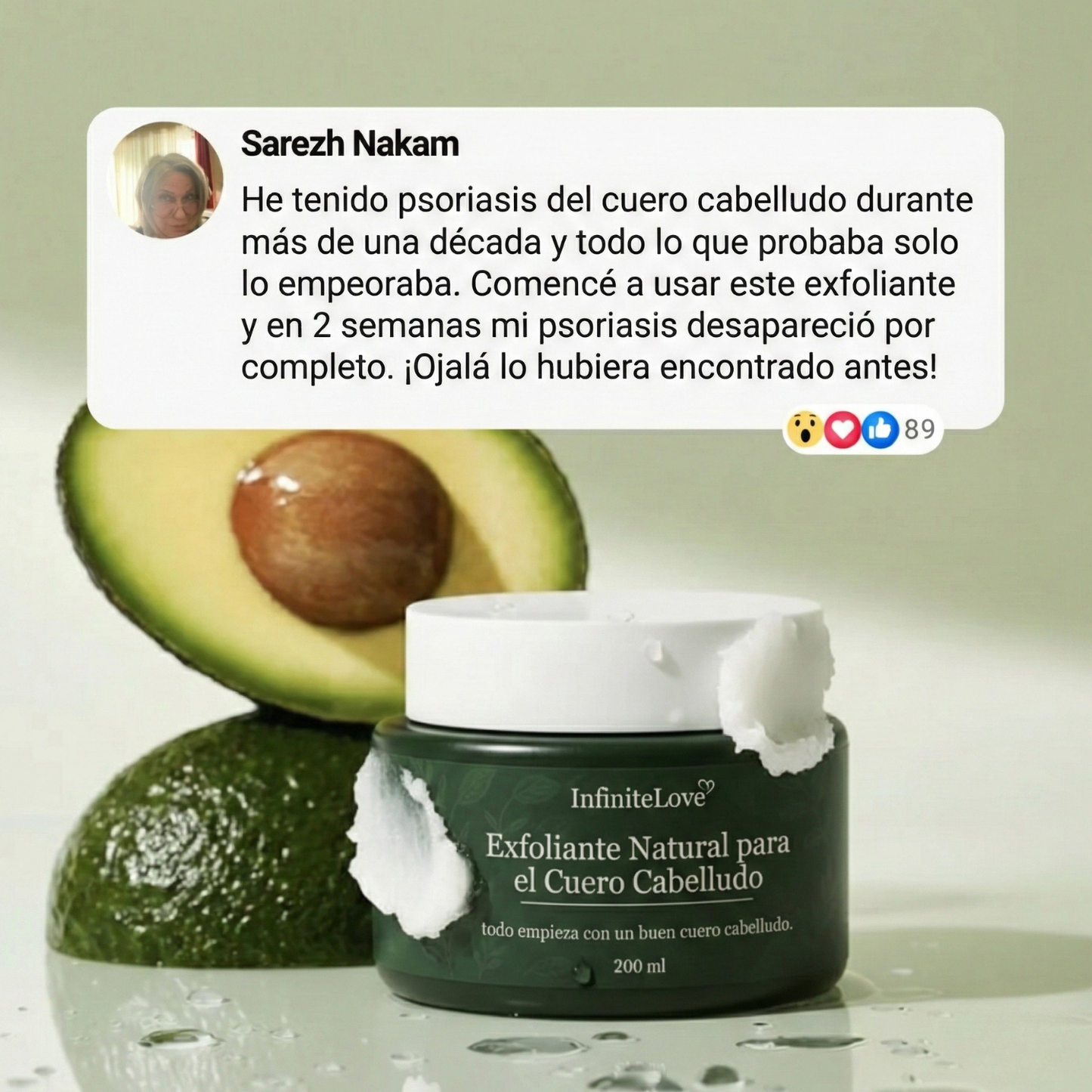 Exfoliante Capilar Natural 'Derma-Calm' con Ácidos Frutales para Psoriasis, Descamación y Alivio del Picor