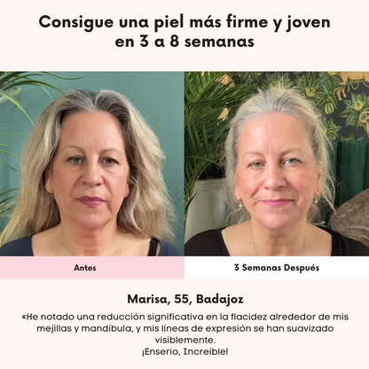 Máscara Facial Anti-Edad de 7 Colores LED y Microcorriente (EMS) para Lifting de Papada y Reafirmar Mejillas
