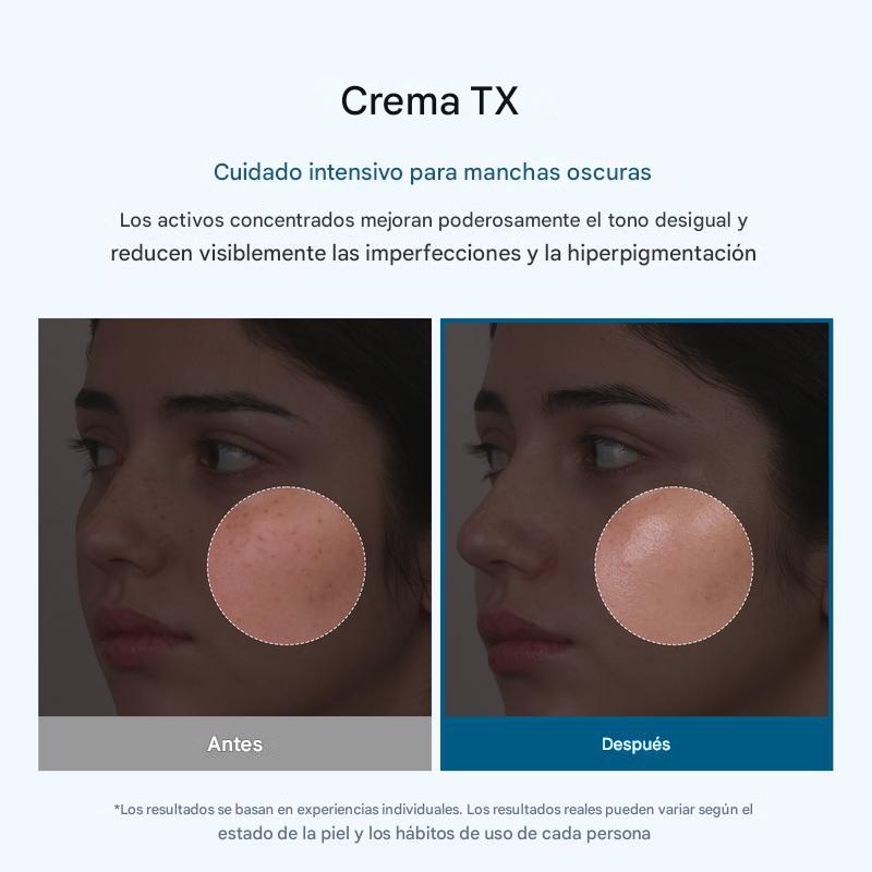 Crema Facial Despigmentante – Reduce Manchas y Unifica Tu Tono