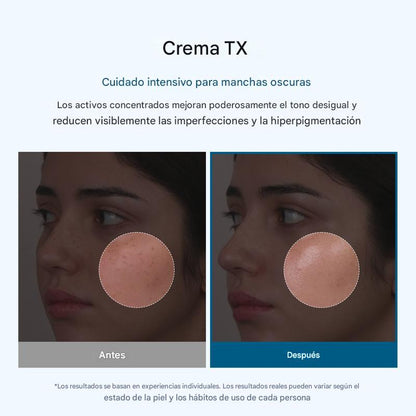 Crema Facial Despigmentante – Reduce Manchas y Unifica Tu Tono