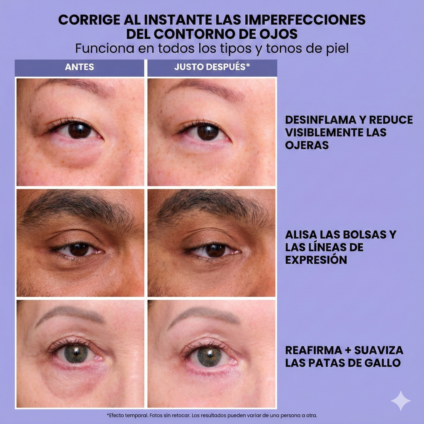 InfiniteLift - Gel tensor rejuvenecedor para tus ojos