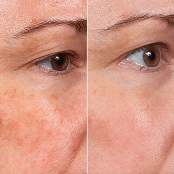 Suero Facial Rejuvenecedor