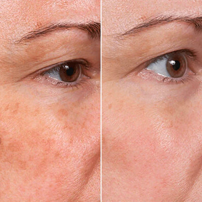 Suero Facial Rejuvenecedor